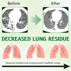 🌿 ODEIUN® 3X Mullein Lung Spray — Flush Out 