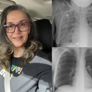 🏆𝐎𝐟𝐟𝐢𝐜𝐢𝐚𝐥 𝐔𝐒 𝐒𝐭𝐨𝐫𝐞🎉Over 100K+ Sold🔥 Dobshow® All-New Upgraded Botanical Mullein Lung Cleanse Diffuser 🌿 — 🫁Restore Your Lung Health